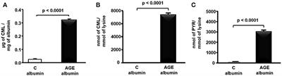 N-acetylcysteine Counteracts Adipose Tissue Macrophage Infiltration and Insulin Resistance Elicited by Advanced Glycated Albumin in Healthy Rats